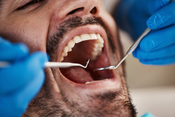 Best Dentist for Tooth Abscess  in Lodi, OH