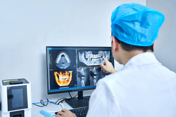 Best Chipped Tooth Repair Near Me  in Lodi, OH